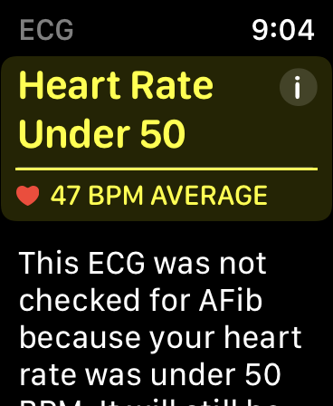 I don’t know think the Apple Watch ECG is going to be helpful for me.